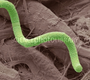 Spirulina sp.              