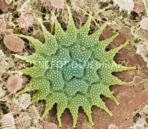 Pediastrum sp.          