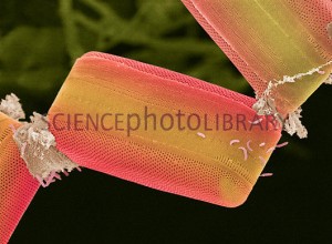 Diatomácea colonial    