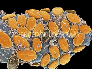 Frústulas de diatomáceas 